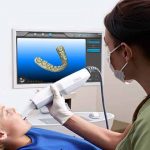 How Digital Impressions are Used in Dentistry