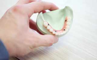 Most Common Dental Procedures